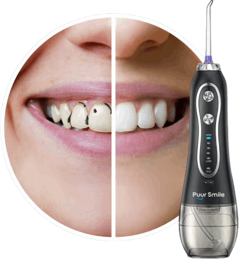 PuurSmile Water Flosser